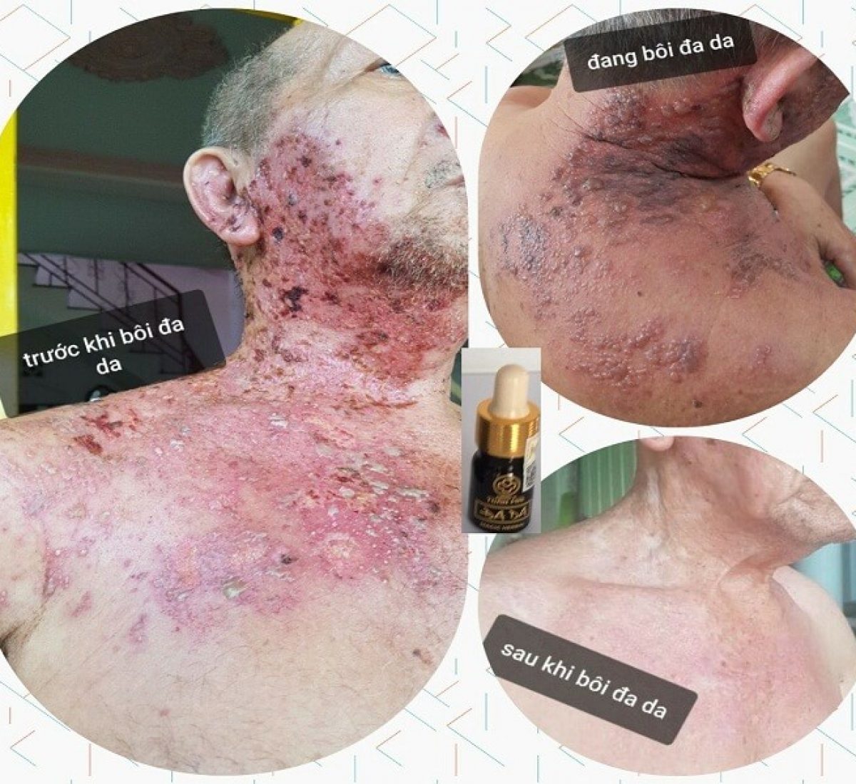 Hinh chú Nguyễn Xuân quang giời leo Hinh chú Nguyễn Xuân quang giời leo