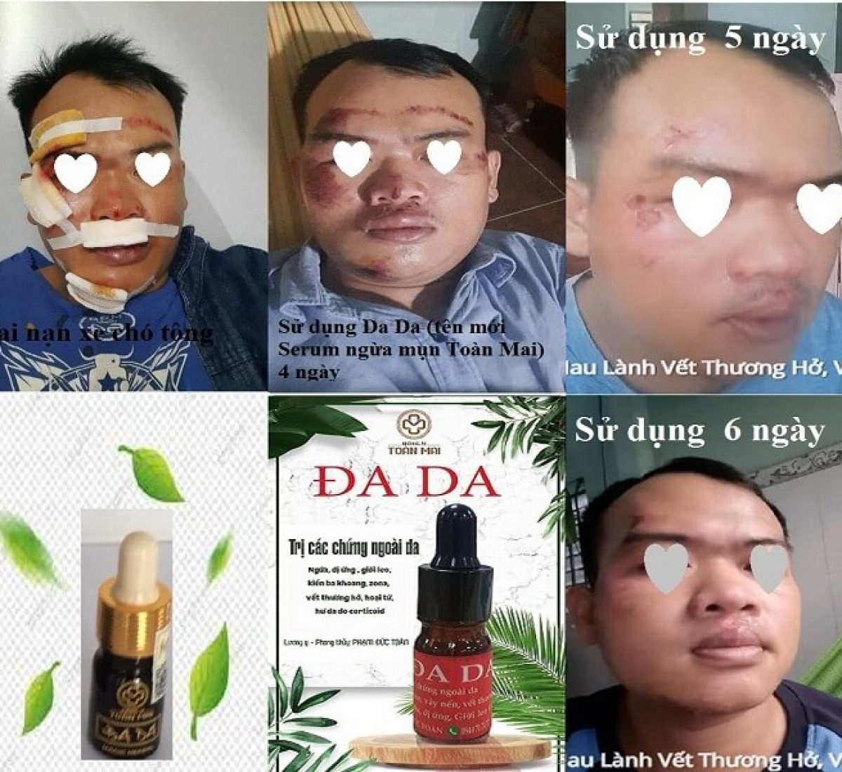 hinhtrang chủ tai nạn xe do chó tông hinhtrang chủ tai nạn xe do chó tông